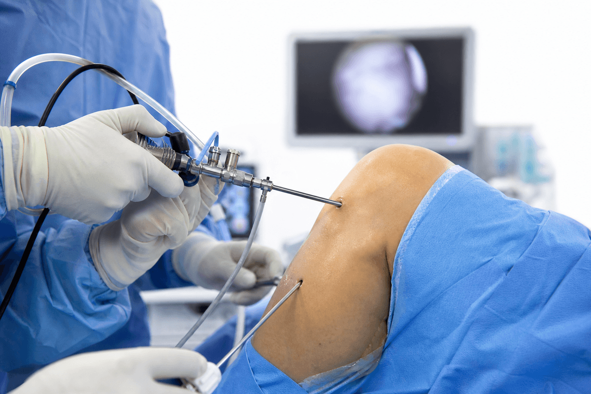 Arthroscopic Surgeries